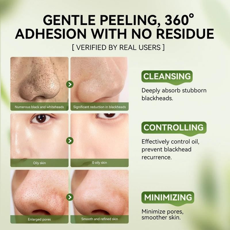 3-In-1 Blackhead Removal Set-Bamboo Charcoal Pore Strips (30G)&Pore Minimizing S