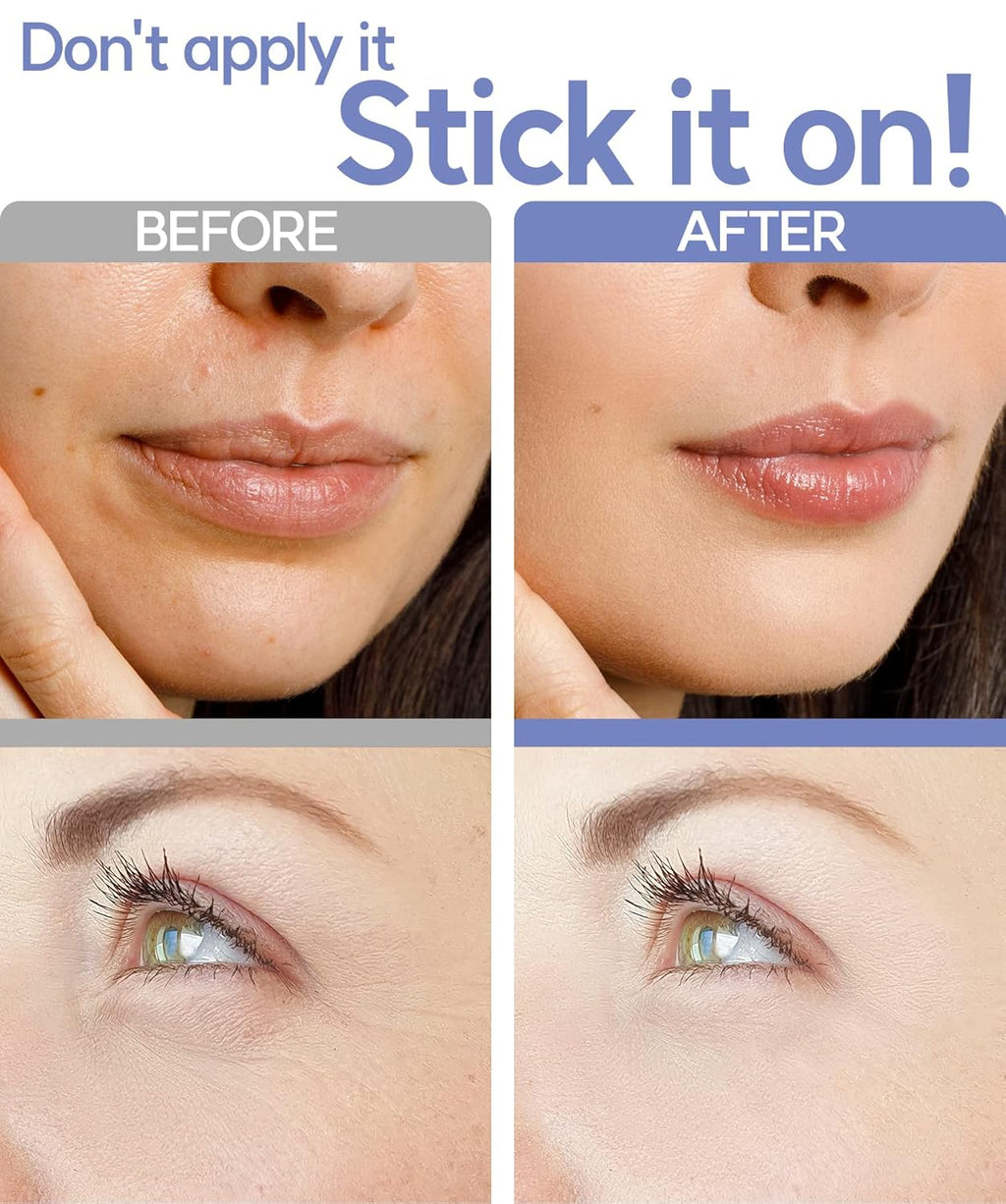 Dissolving Microdart Depuffing Patches for under Eye and Smile Line with Hyaluronic Acid and Tea Tree - 3 Pairs - anti Wrinkle Patches for Face Overnight