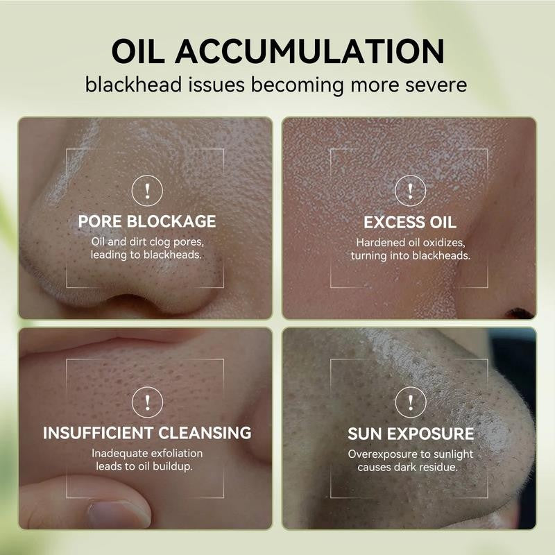 3-In-1 Blackhead Removal Set-Bamboo Charcoal Pore Strips (30G)&Pore Minimizing S