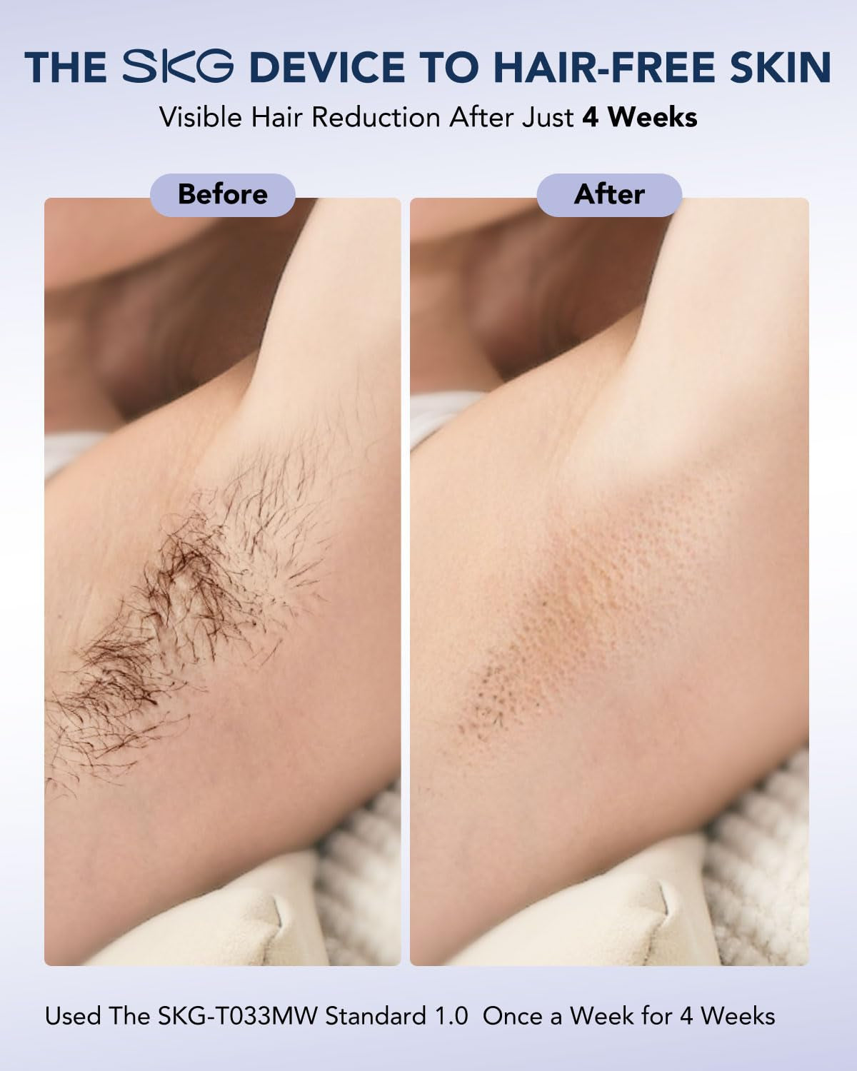 Laser Hair Removal Device for Women Men, at Home Painless IPL Hair Removal with Infinite Flashes, Dual-Pulse, 25 Minutes Rapid Hair Removal, IPL System for Facial Legs Arms Bikini Line Whole Body