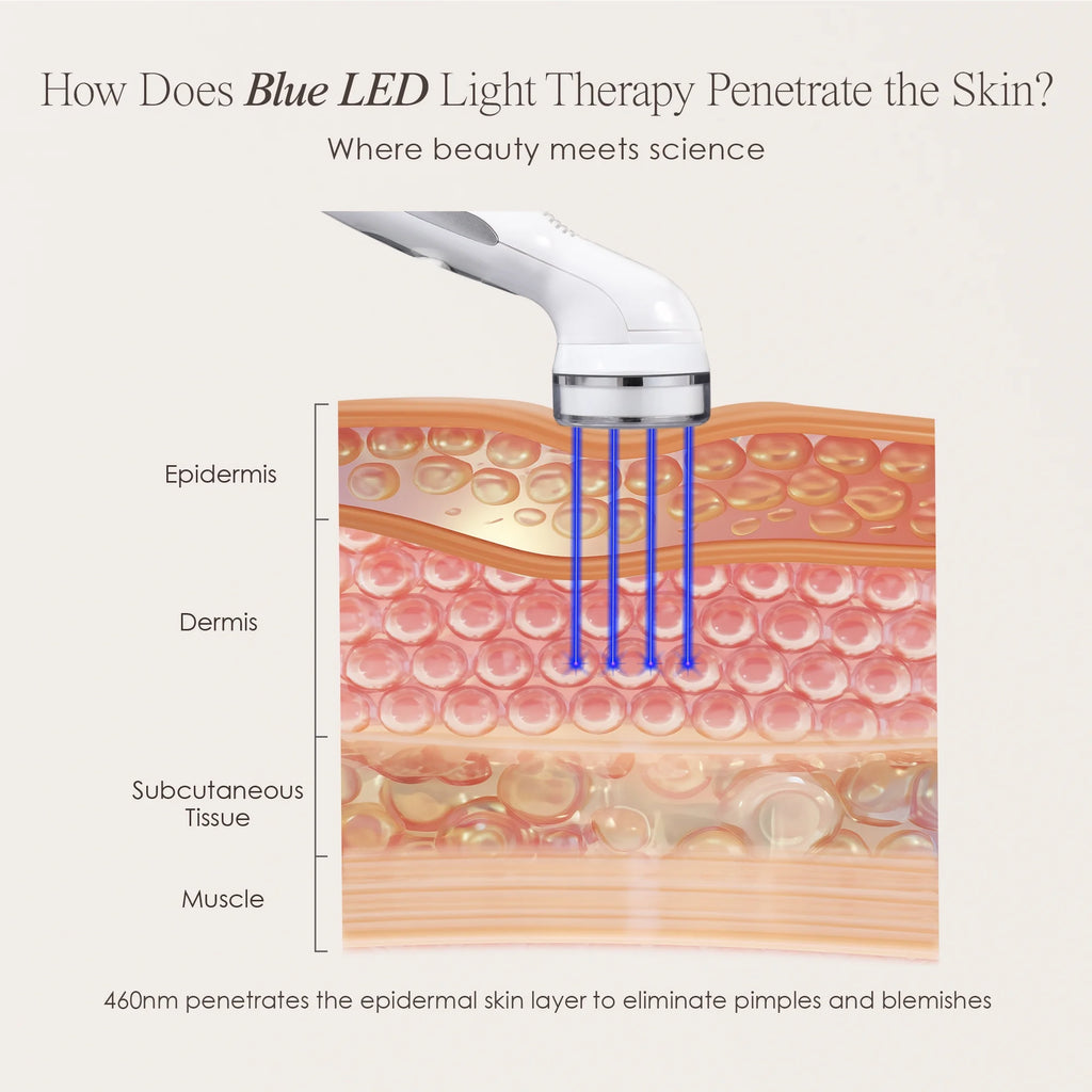 Blue LED+ | Acne Light Therapy | Spots Removal | Minimize Pores | for Oily Skin