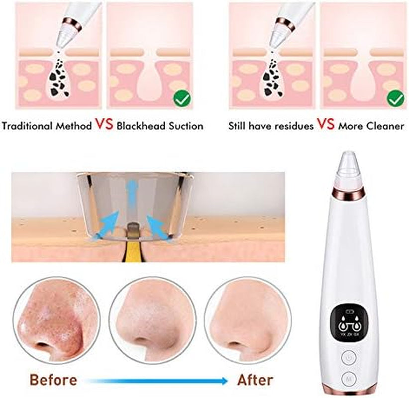 Blackhead Remover Pore Vacuum Tool Kit - 6 Suction Heads, 3 Modes, Pore Cleansing Blackhead Vacuum,Ideal for Men and Women